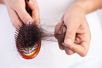 Hair loss