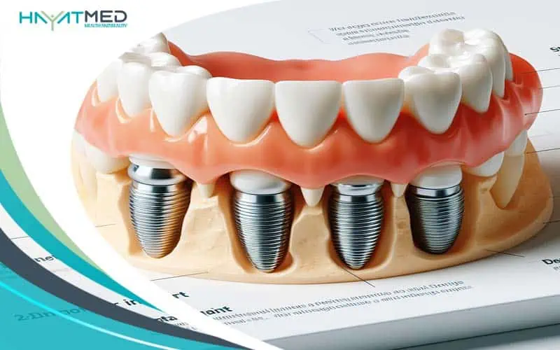 dental implants in Turkey